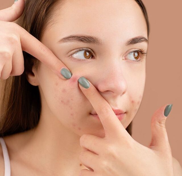 What causes blind pimples?