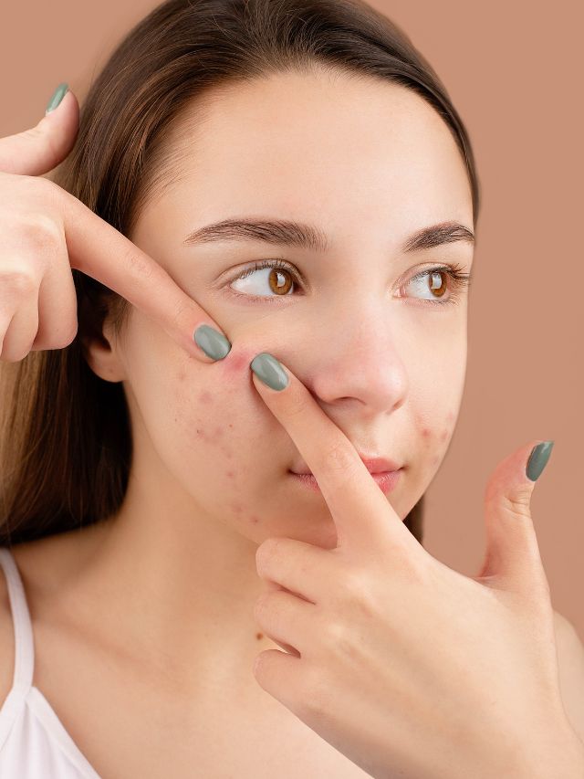 What causes blind pimples?